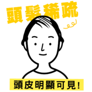 地中海禿頭有救嗎？原因、前兆 …