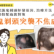 鬼剃頭突襲不焦慮!認識鬼剃頭好發原因、治療方法與假髮過度對策