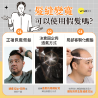 錯誤的配戴習慣可能會對頭皮造成負擔,但只要選對方法,假髮其實是改善髮縫變寬的最佳輔助工具。關鍵在於選擇具備高透氣性的底網材質並採用正確的固定方式。