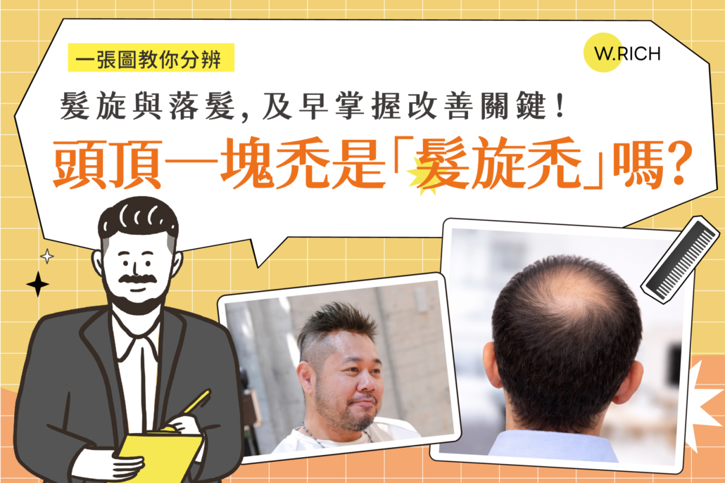 髮旋與落髮，及早掌握改善關鍵！頭頂一塊禿是髮旋禿嗎？ - W.RICH