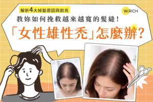 女性雄性禿怎麼辦？4大掉髮原因與前兆解析－髮縫越來越寬如何挽救完整改善指南