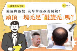 頭頂一塊禿是髮旋禿還是落髮？一張圖分辨髮旋與落髮差異－及早掌握改善關鍵完整指南